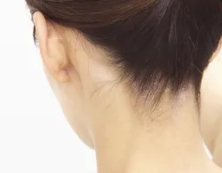 首の症状について
